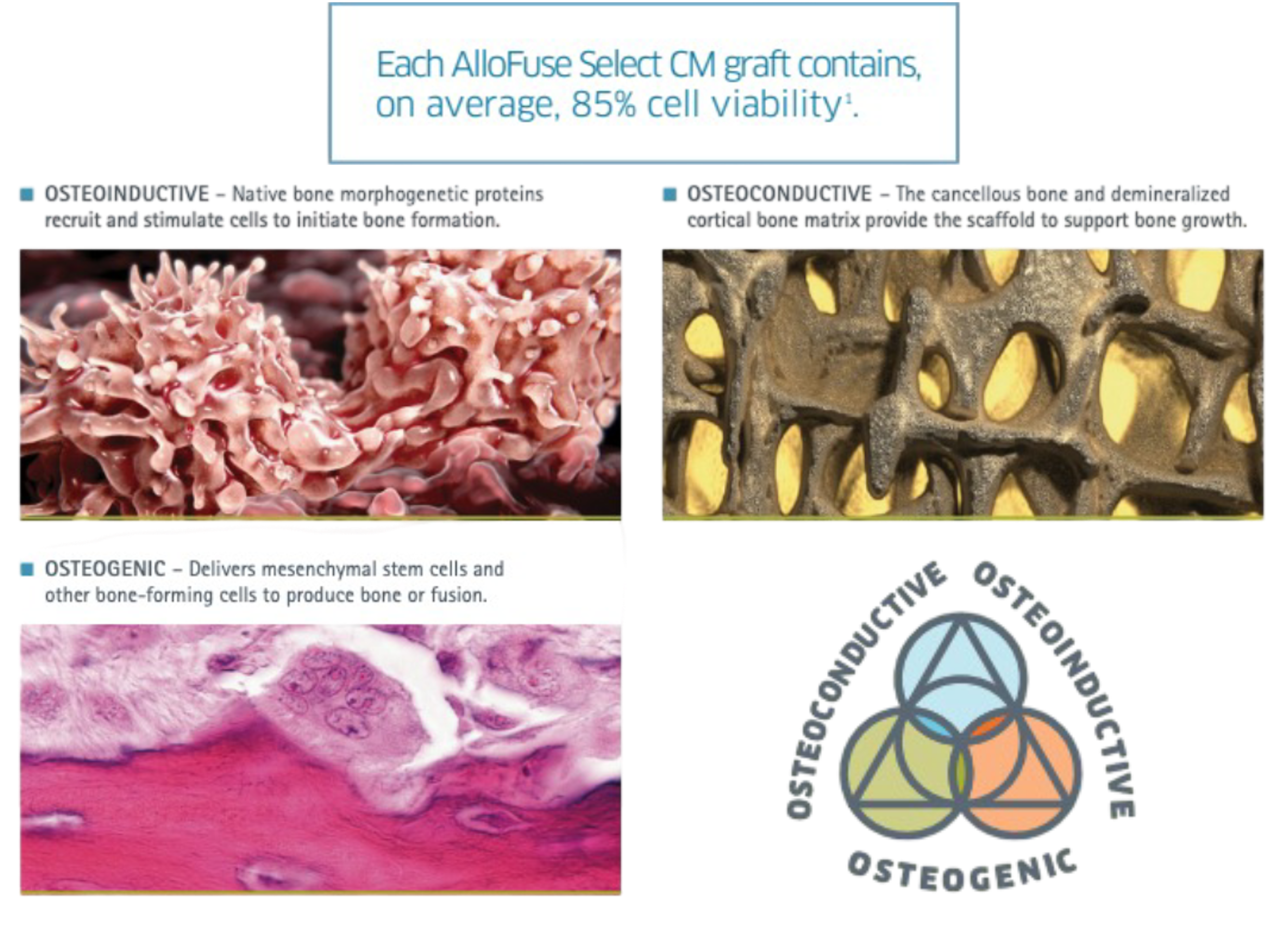 AlloFuse® Select CM | Spartan Medical